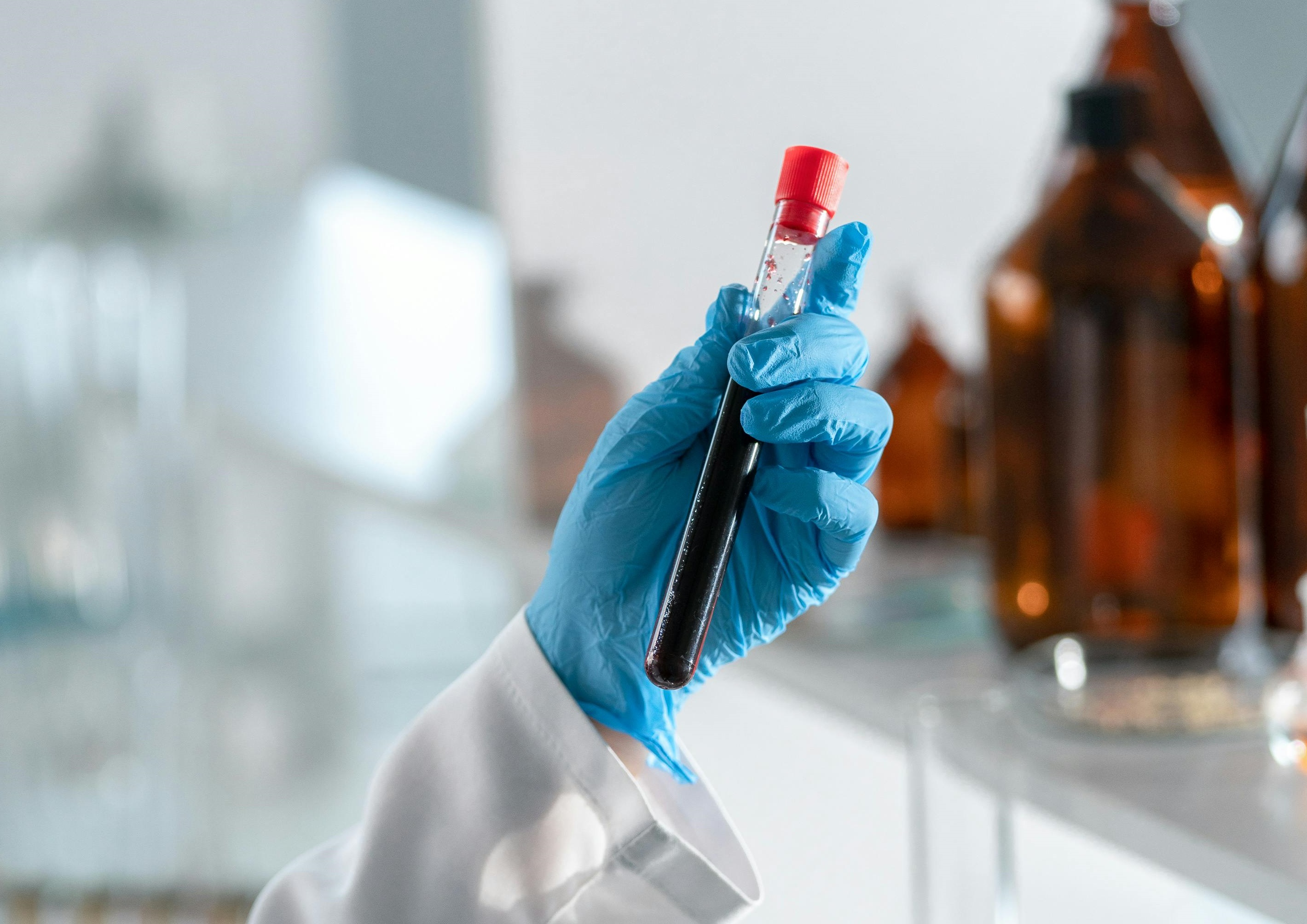 Bezpłatne badania w Przecławiu. Markery nowotworowe